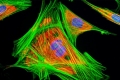 2nd School on ADFLIM (Advanced FLuorescence Imaging Methods)